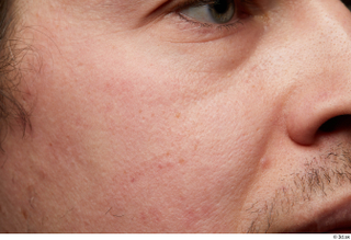 HD Skin Brandon Davis cheek face head mustache skin pores…